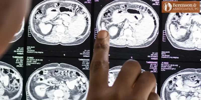 abogado de lesiones cerebrales traumáticas en albuquerque