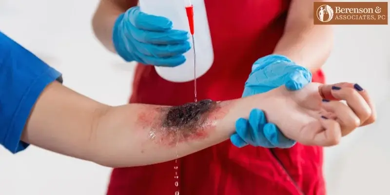 best las cruces burn injury lawyer best las cruces burn injury lawyer